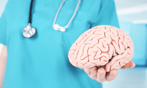 Nurse holding a brain